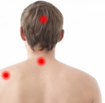 Les projecteurs de l'ostéochondrose